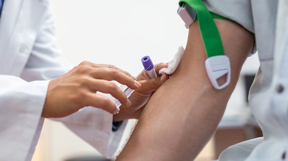 Αιμοκάθαρση: Μια απαραίτητη θεραπεία για τη νεφρική ανεπάρκεια